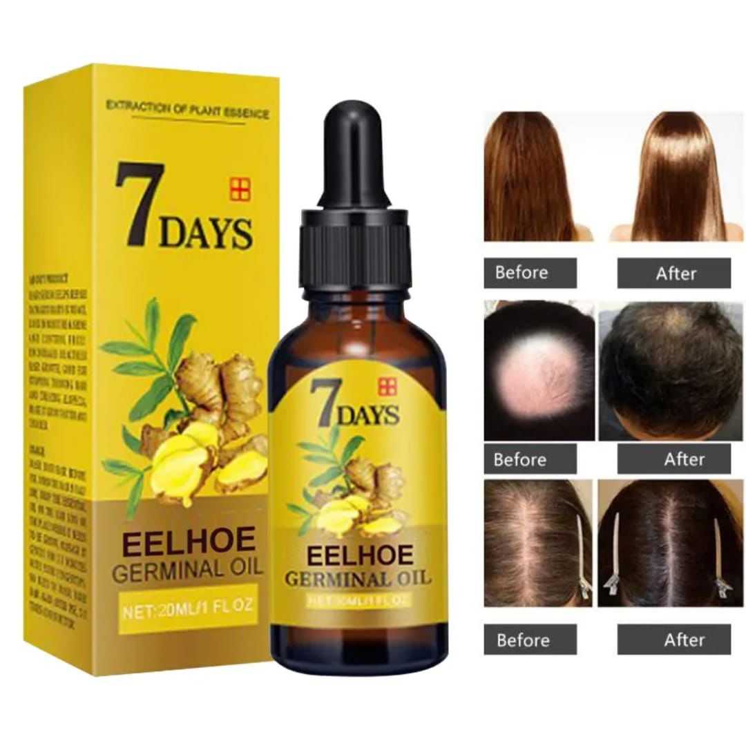7-Day,Fast,Hair,Growth,Oil,with,Ginger,Treatment,Nourishing,Scalp,Serum,Organic,Vegan,Ingredients,for,Men,and,Women
